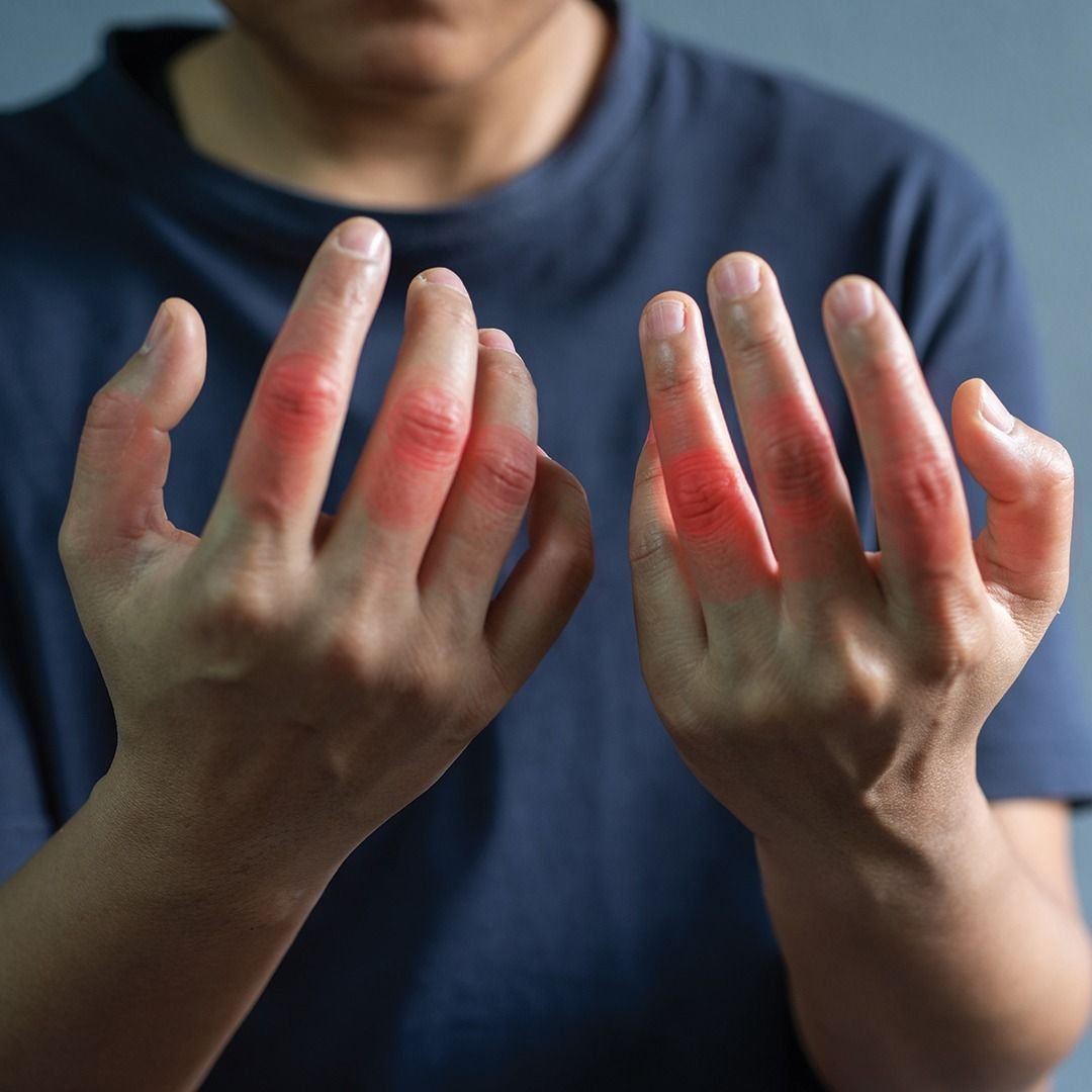 Soft-tissue rheumatism